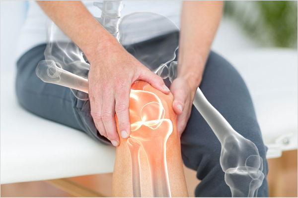 무릎 보호: 운동과 스포츠 중 관절 통증을 예방하는 전문가 팁